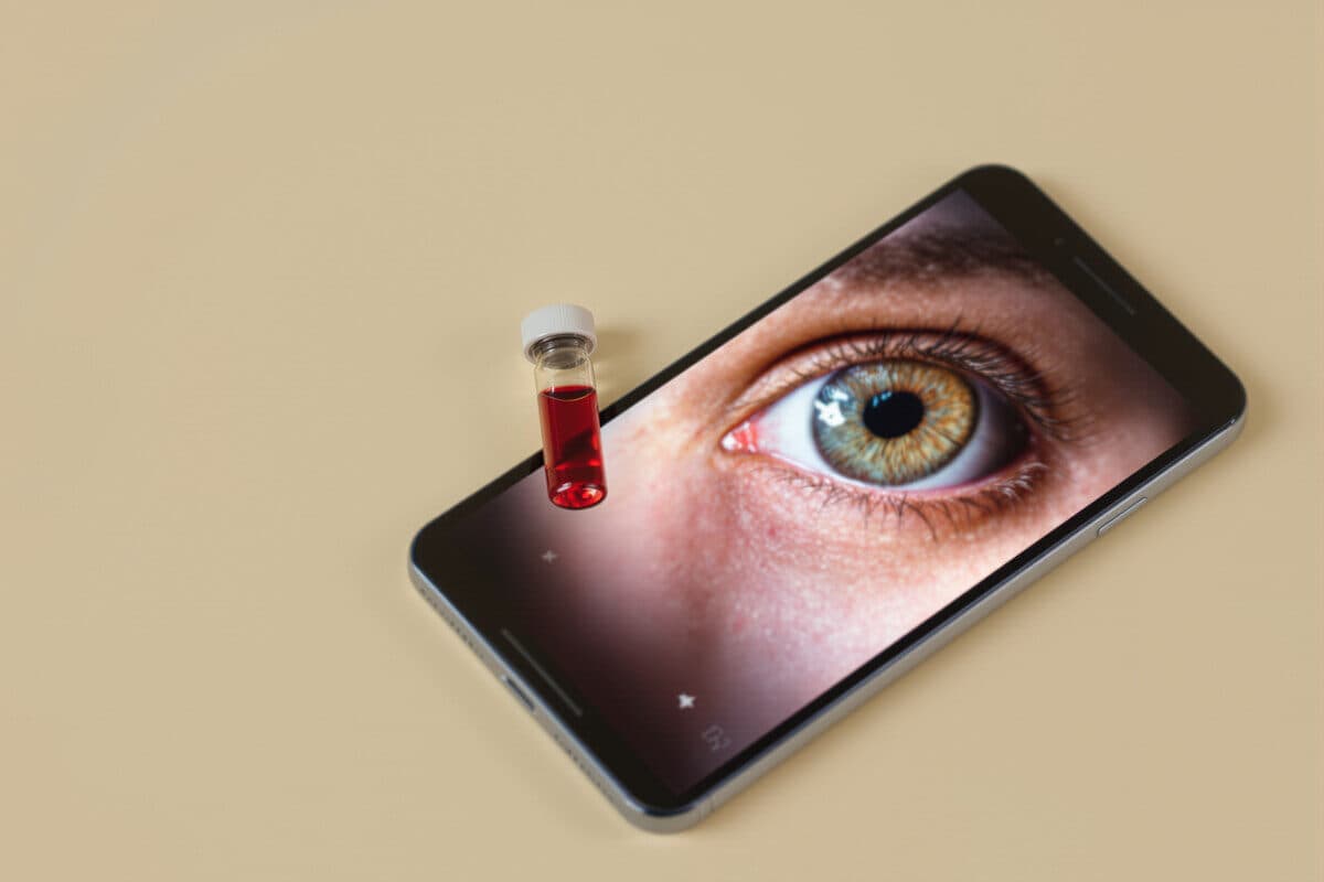Iris Scan vs. Blood Panel: What Each Tells You About Your Health